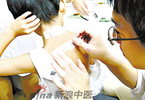 灸法的種類  你知道多少？